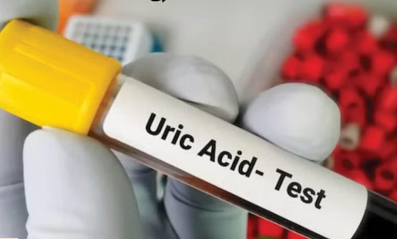 Health Tips: चुनौती बन रही Hyperuricemia, Uric Acid के उच्च स्तर की पहचान आसान नहीं, आइये जानते हैं कैसे